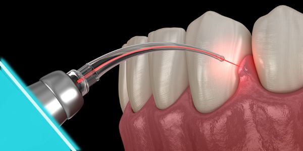 periodontoloji2