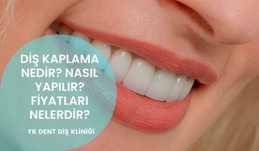 Diş Kaplama