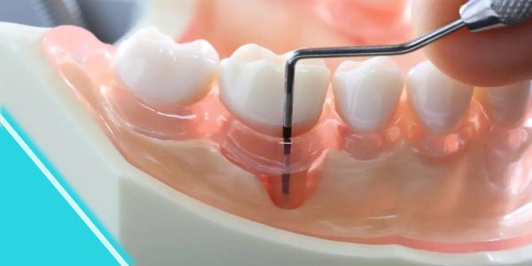 periodontoloji1