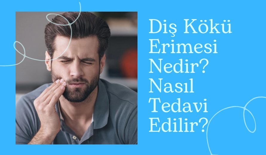 Diş Kökü Erimesi