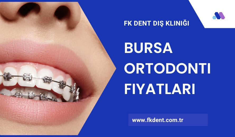 Bursa Ortodonti Fiyatları