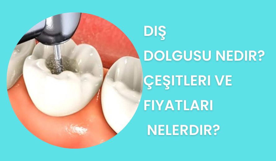 diş boşluğu dolgusu