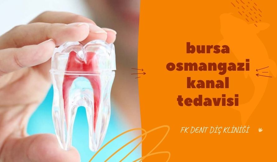 Bursa Osmangazi Kanal Tedavisi