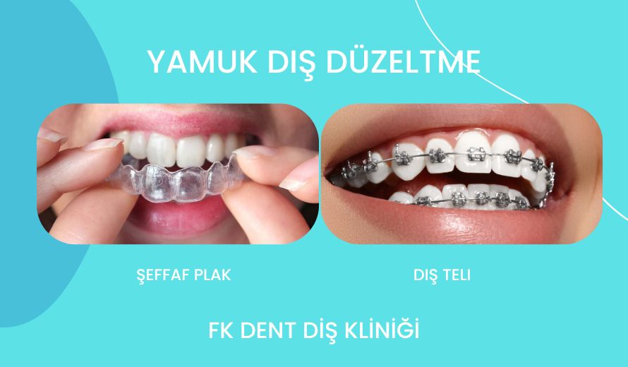 Yamuk Diş Düzeltme